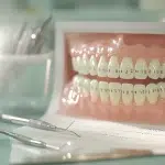 numérotation des dents